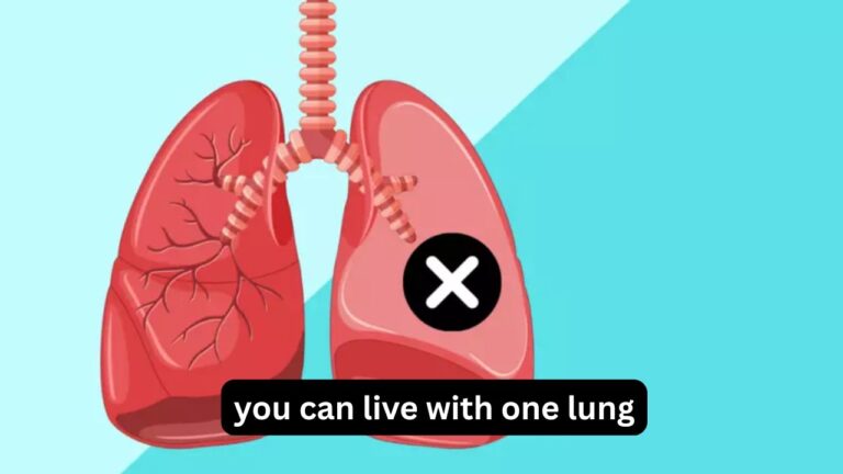 You Can Live With One Lung: What Life Is Really Like You Can Live With One Lung